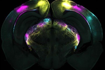 Pesquisa revela mecanismo cerebral que ajuda a superar o medo